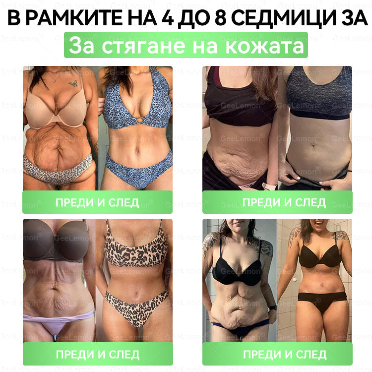 🎉Ограничена по време оферта🎉𝐆𝐞𝑒𝑙𝑒𝐦𝐨𝐧® Glum𝐚𝐬𝐞tide 8 в 1 – Нано микроиглен пластир за отслабване|Само 1× дневно ✅ Видими промени за 7 дни – при затлъстяване, сърдечно-съдово здраве, диабет и ставни проблеми