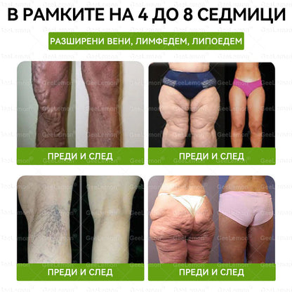 Ограничена оферта🍀🍀𝐆𝐞𝑒𝑙𝑒𝐦𝐨𝐧® Glum𝐚𝐬𝐞tide 8 в 1 – Нано микроиглен пластир за отслабване|Само 1× дневно ✅ Видими промени за 7 дни – при затлъстяване, сърдечно-съдово здраве, диабет и ставни проблеми 🍀🍀 (Copy)